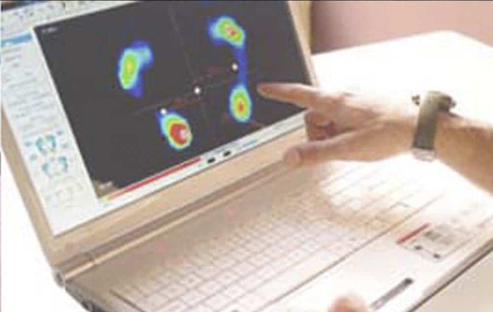 Estudios Biomecánicos en Alcalá de Henares